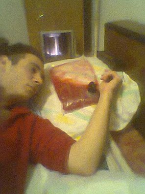 perfuzie cu suc de sfecla